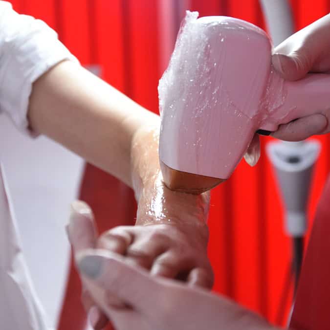 Hair Removal