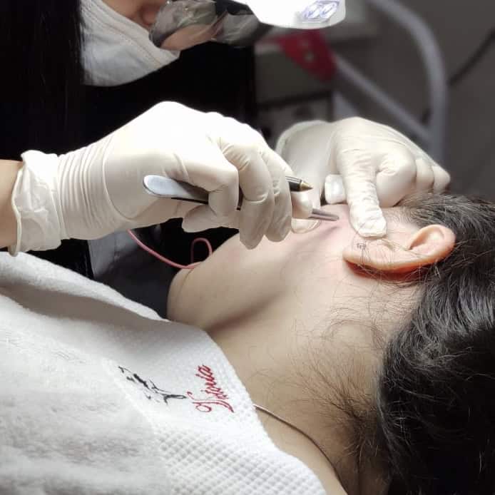Electrolysis in Tbilisi